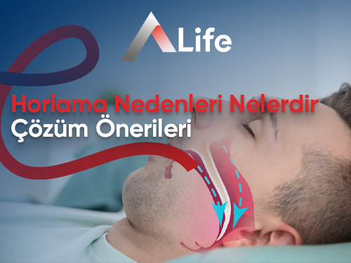 Horlama Nedenleri Nelerdir? Çözüm Önerileri